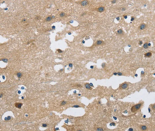 FGF9 Polyclonal Antibody - image 2
