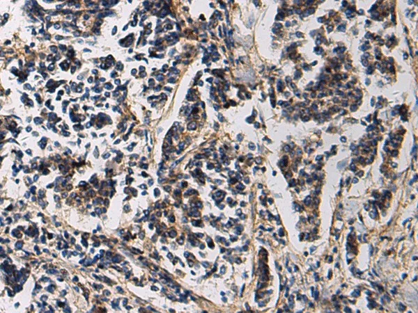 SSH3 Polyclonal Antibody - image 1