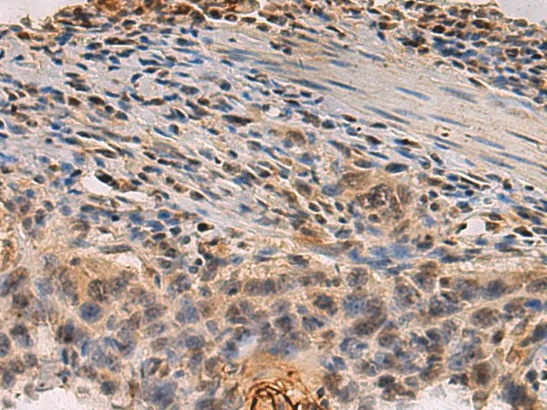 PDS5B Polyclonal Antibody - image 1
