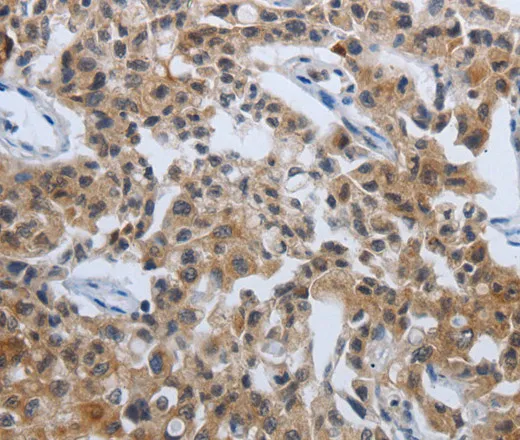 PDCD7 Polyclonal Antibody - image 1