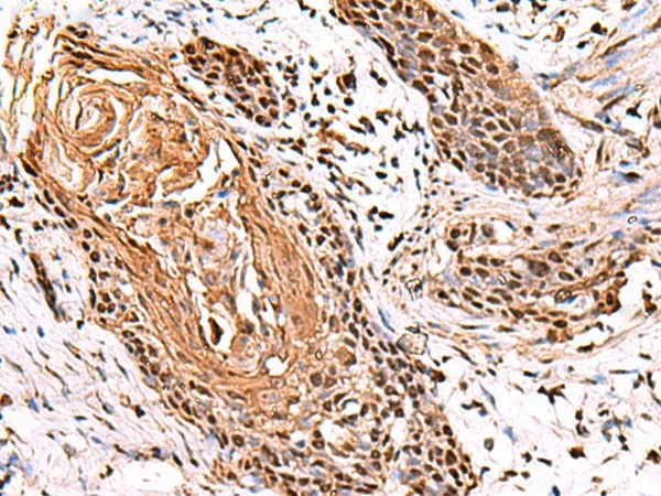 ITPR2 Polyclonal Antibody - image 1