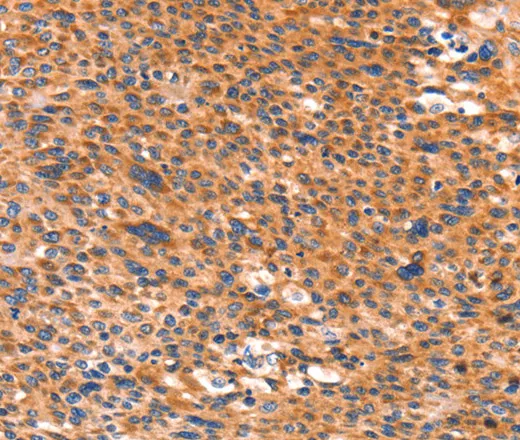 AMPD1 Polyclonal Antibody - image 1