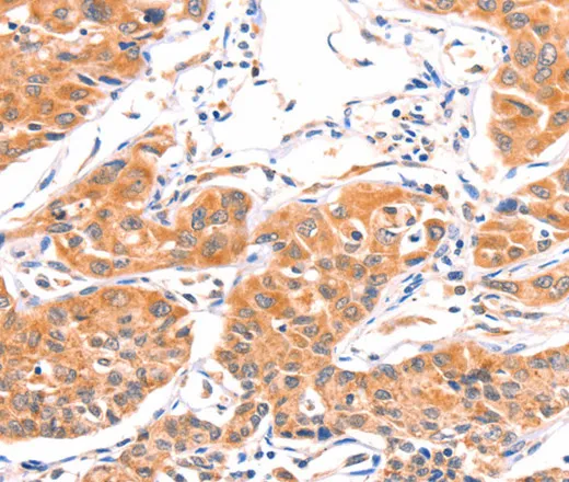 AMPD1 Polyclonal Antibody - image 2