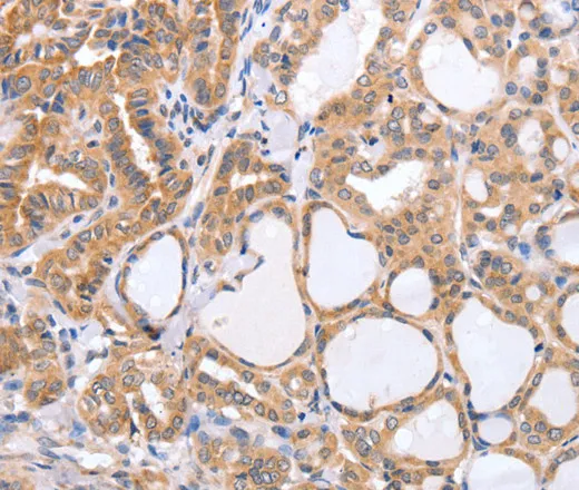 TGFA Polyclonal Antibody - image 1