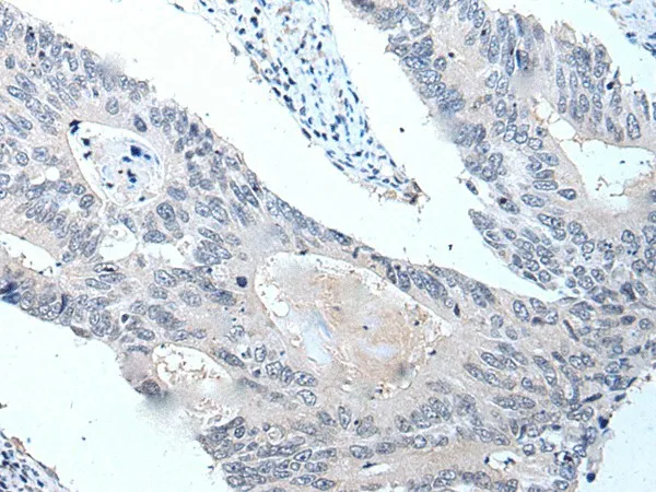 VPS35 Polyclonal Antibody - image 1