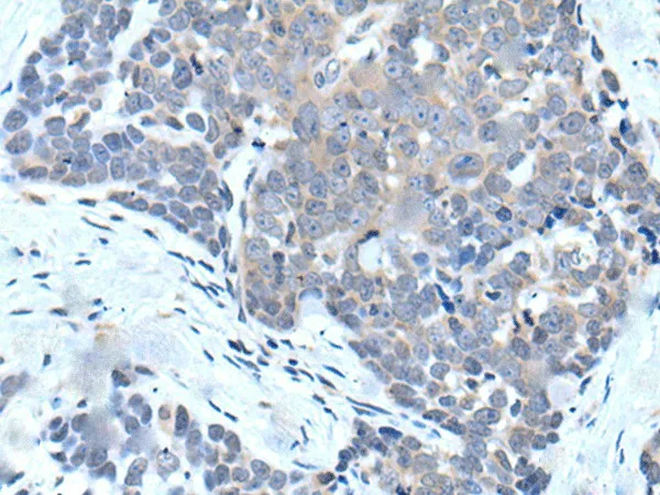 VPS35 Polyclonal Antibody - image 2