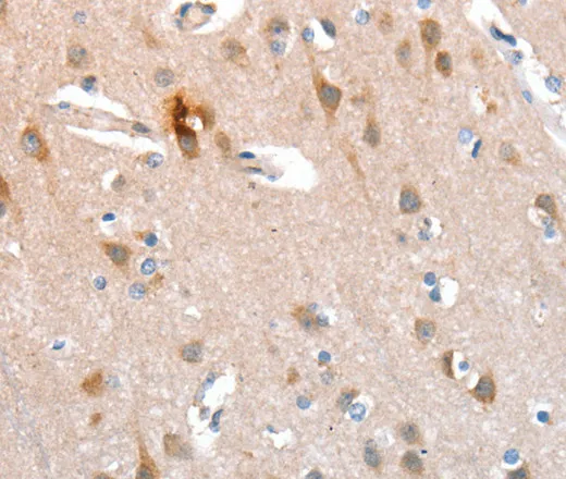 CD238 Polyclonal Antibody - image 1