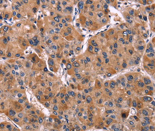 LILRB1 Polyclonal Antibody - image 1