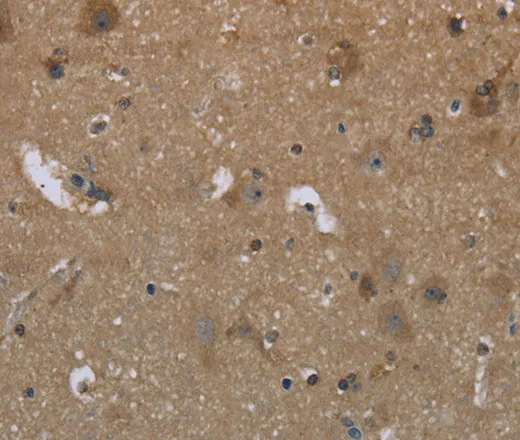 GYS2 Polyclonal Antibody - image 1