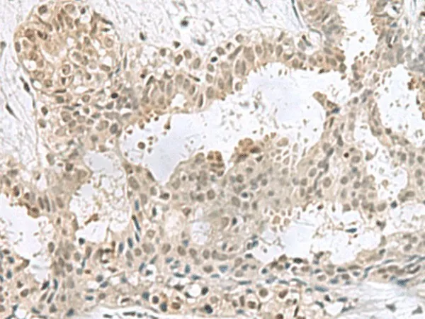 PCBD1 Polyclonal Antibody - image 1