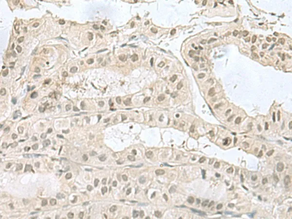 PCBD1 Polyclonal Antibody - image 2