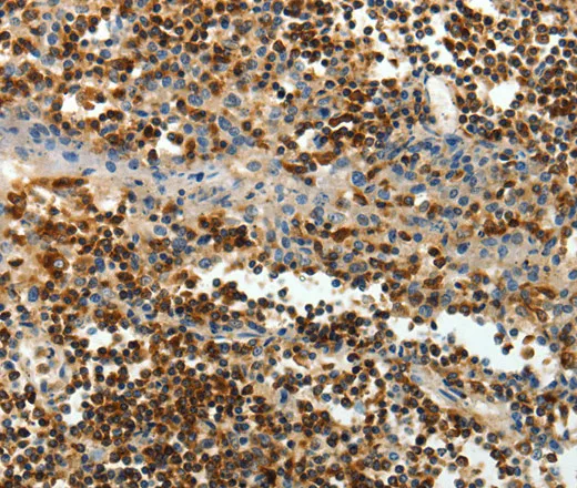 AMD1 Polyclonal Antibody - image 1