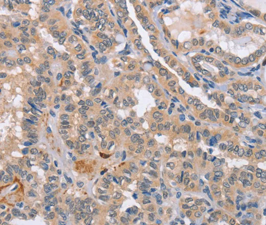 CD36 Polyclonal Antibody - image 1