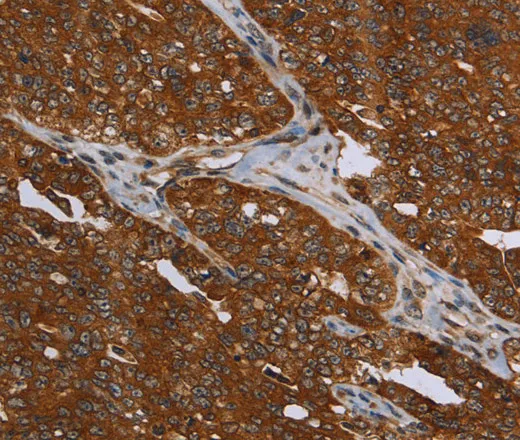 MCHR1 Polyclonal Antibody - image 1