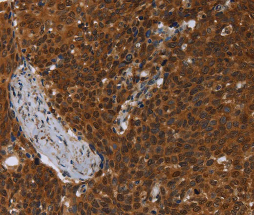 MCHR1 Polyclonal Antibody - image 2