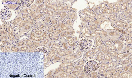 JAK2 Polyclonal Antibody - image 1
