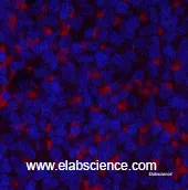 JAK2 Polyclonal Antibody - image 2