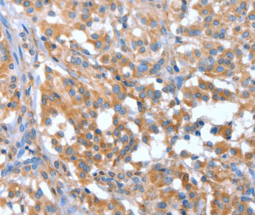 NOD2 Polyclonal Antibody - image 1
