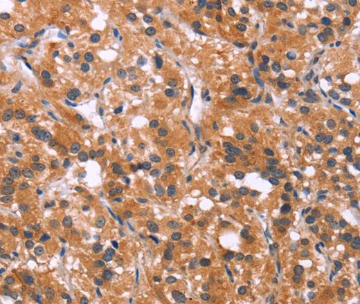 MAPK11 Polyclonal Antibody - image 1