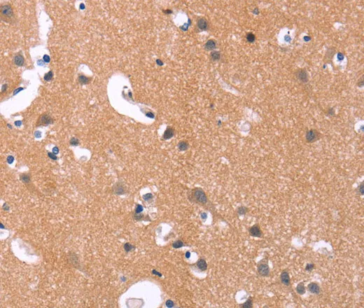 MAPK11 Polyclonal Antibody - image 2