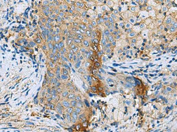 CLTB Polyclonal Antibody - image 1