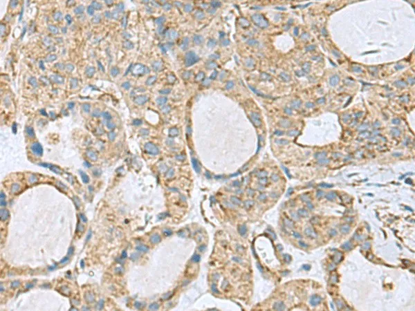 CLTB Polyclonal Antibody - image 2