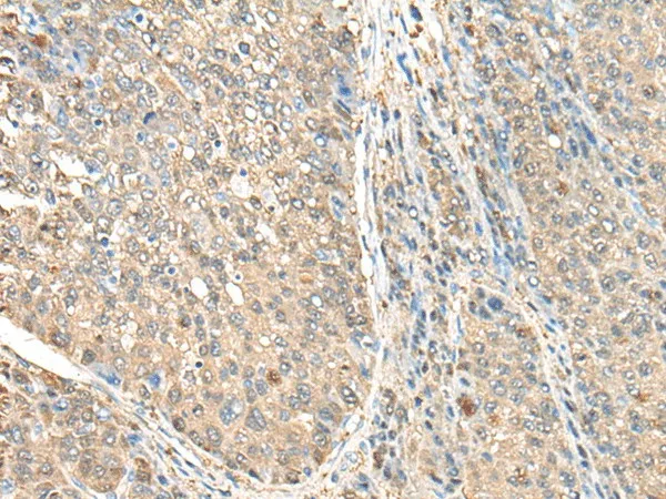 ASS1 Polyclonal Antibody - image 1