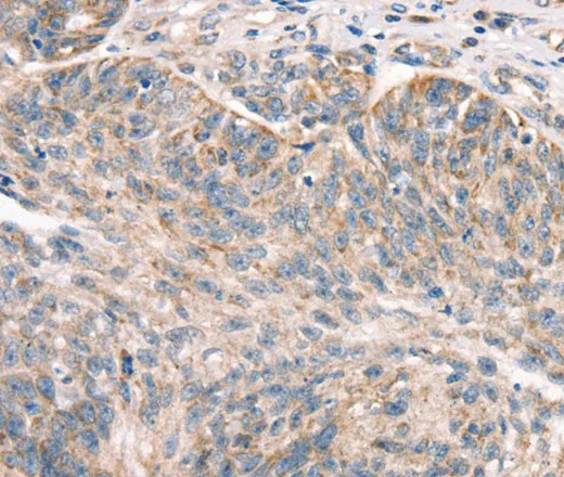 DECR1 Polyclonal Antibody - image 1