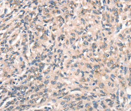 DECR1 Polyclonal Antibody - image 2