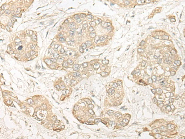 COMT Polyclonal Antibody - image 1