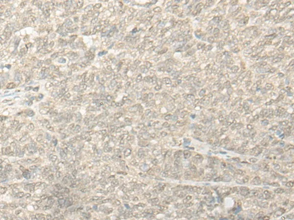 COMT Polyclonal Antibody - image 2
