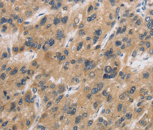 CST6 Polyclonal Antibody - image 1