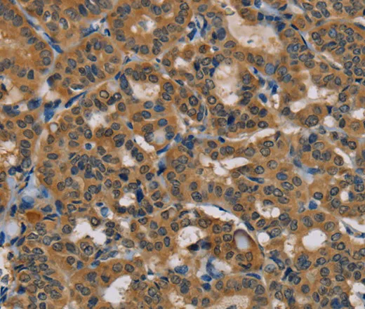 TAB3 Polyclonal Antibody - image 1