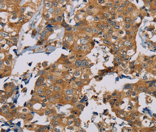 TAB3 Polyclonal Antibody - image 2