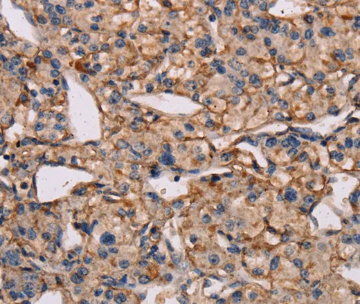 IL12RB2 Polyclonal Antibody - image 1