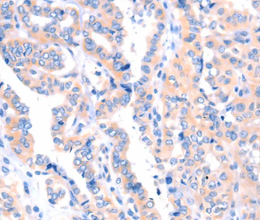 APBA2 Polyclonal Antibody - image 1