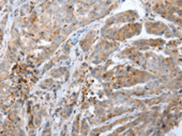 CALB2 Polyclonal Antibody - image 1