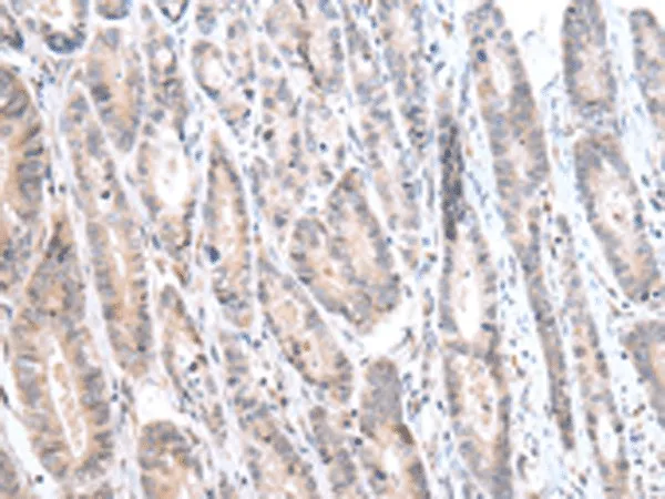 CALB2 Polyclonal Antibody - image 2