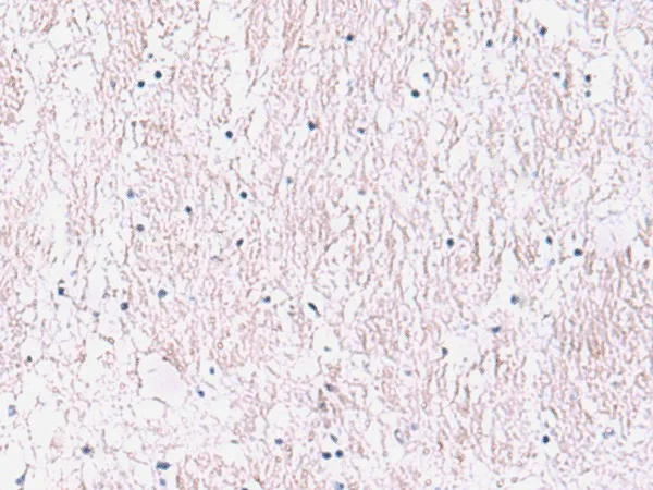 SMPD2 Polyclonal Antibody - image 1