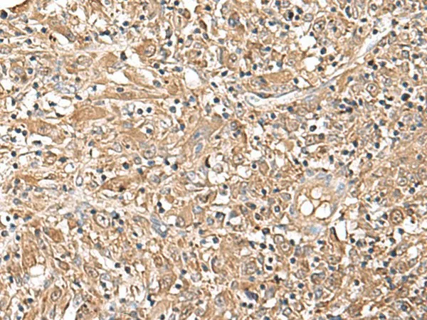 LEPR Polyclonal Antibody - image 1