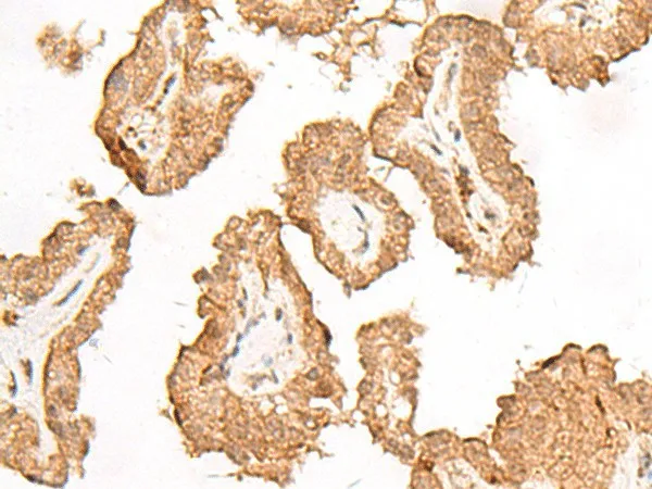 FGF13 Polyclonal Antibody - image 1