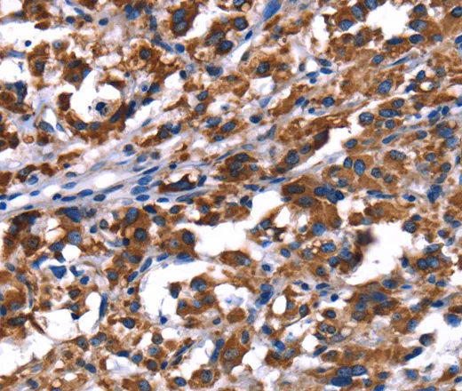 PHB Polyclonal Antibody - image 2