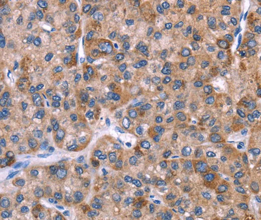 EVC2 Polyclonal Antibody - image 1