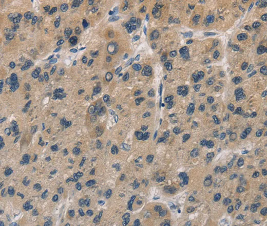 DUSP26 Polyclonal Antibody - image 1
