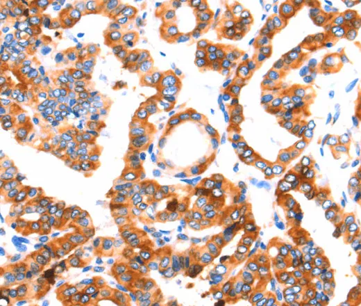 SEPT4 Polyclonal Antibody - image 1