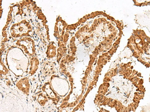 GRASP Polyclonal Antibody - image 1