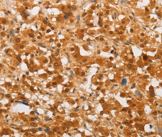 THOC7 Polyclonal Antibody - image 1