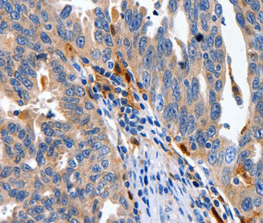 IL18 Polyclonal Antibody - image 1