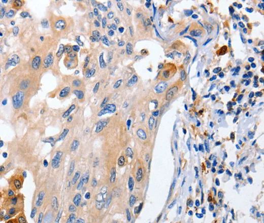 IL18 Polyclonal Antibody - image 2