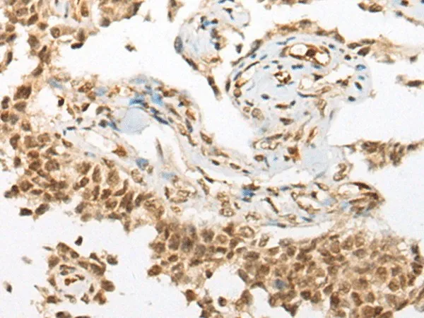 ATN1 Polyclonal Antibody - image 1